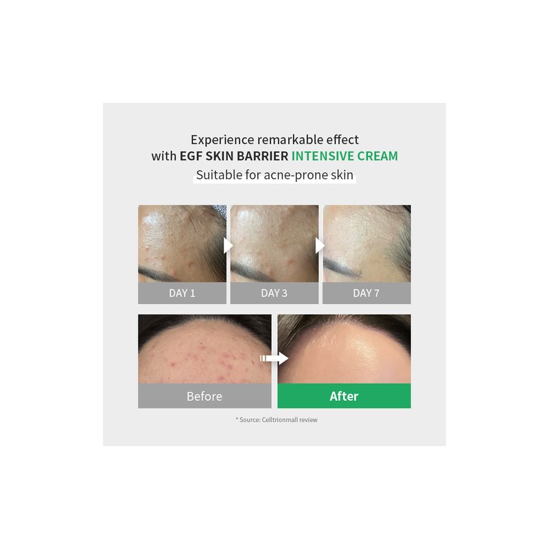 zipiderm [zipiderm]EGF Skin Barrier Intensive Cream 80ml
