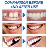 Temporary Tooth Repair Kit, Moldable Filling for Temporary Tooth Repair