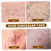 OHPHCALL Scar Cover Sticker Concealing Tape for Skin Breathable Material