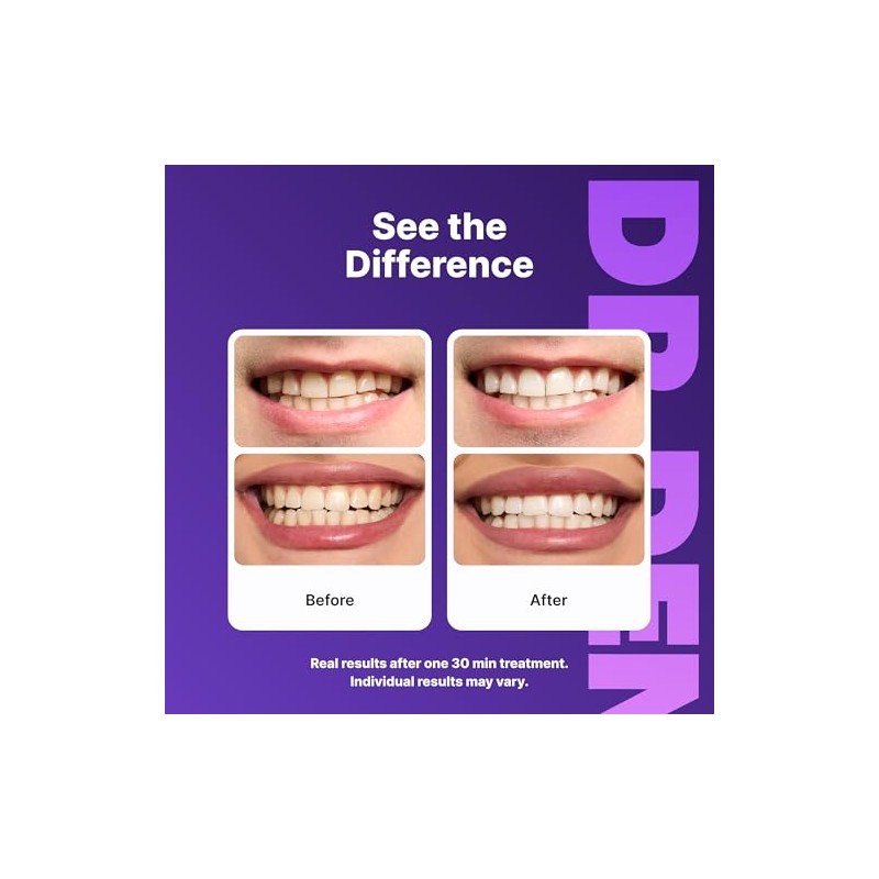 DR.DENT Purple Teeth Whitening Strips 7 Treatments - Enamel Safe