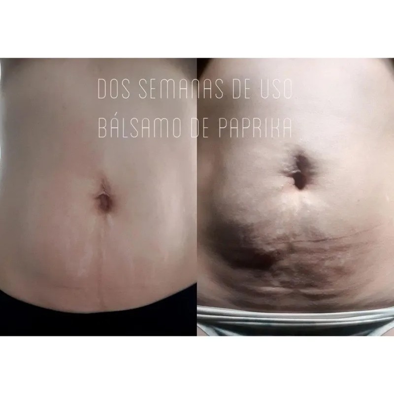 Pack 2 Geles Paprika Estrias, Flacidez, Celulitis Farmasi