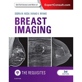 Breast Imaging