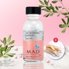 M.A.D Acne Drying Lotion 30ml Trouble Spot + Cotton Swab