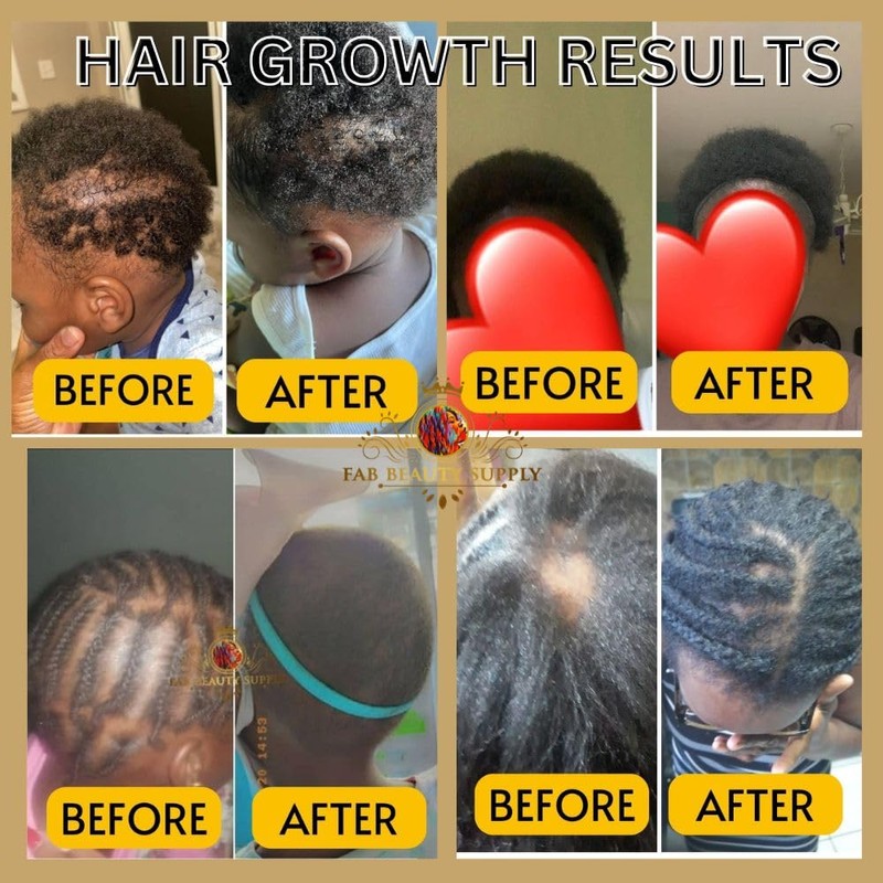 Fab Beauty Supply Extra Strength Hair Oil - Thinning Hair,
