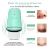 Limpiador Facial Peeling Ultrasónico Portatil Skin Scrubber
