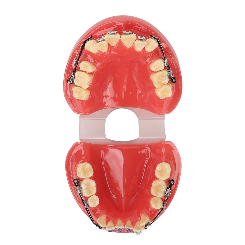 Professional Dental Demonstration Orthodontic Model with Metal Wires and Bracket