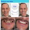 Denture Smile Teeth Customizable Temporary Perfect Fake Teeth Molds Braces