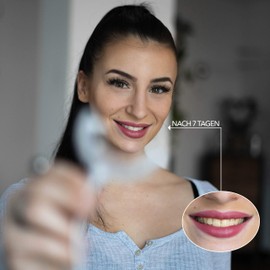 BigPack - The Golden Smile ™ | Professionelles Zahn Bleaching Set Zahnaufhellung mit Natürlichem Aktivkohle Pulver Teeth Whitening Kit Homebleaching Zahnweiß