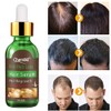 Hair Growth Serum - Treats Hair Loss & Thinning, Stimulates
