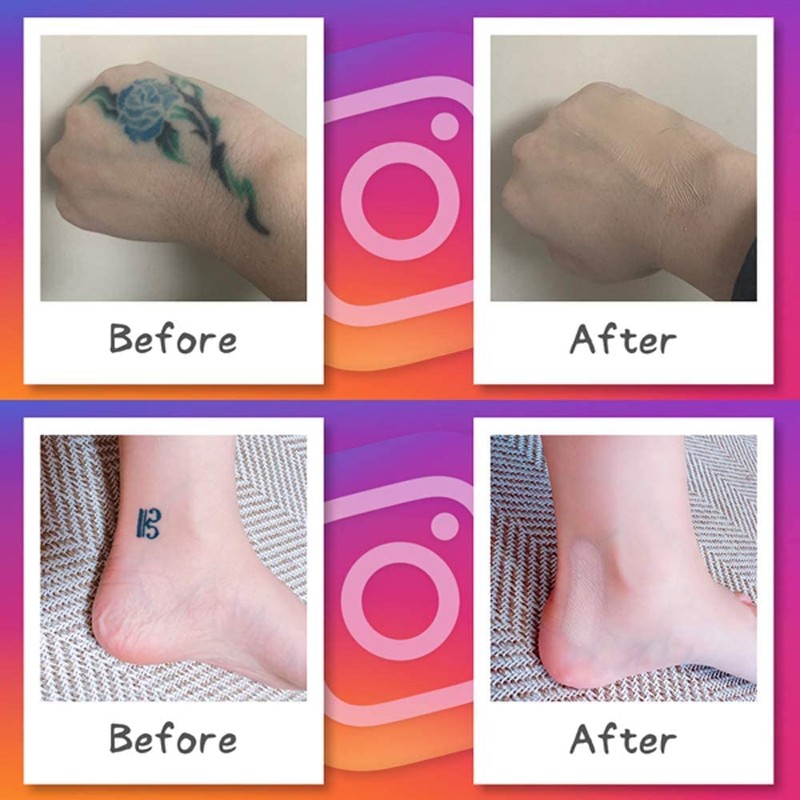 Foundation Tape (Hide Tattoo Stickers) Bandage Size, Same Color, 6