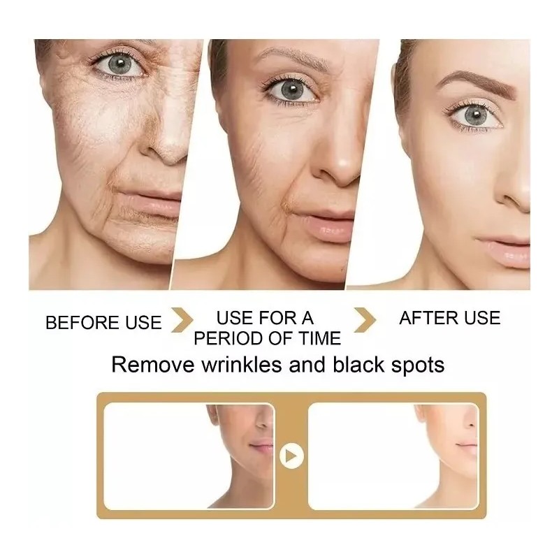 Serum Despigmentante Aclarante Paño Pecas Manchas Ojeras30ml Todo Tipo De