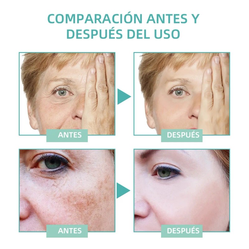 Ab La Crema Correctora De Manchas Aclara Las Manchas Oscuras