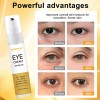 2pcs Retinal Shot Tightening Booster 15ml Todo Tipo De Piel