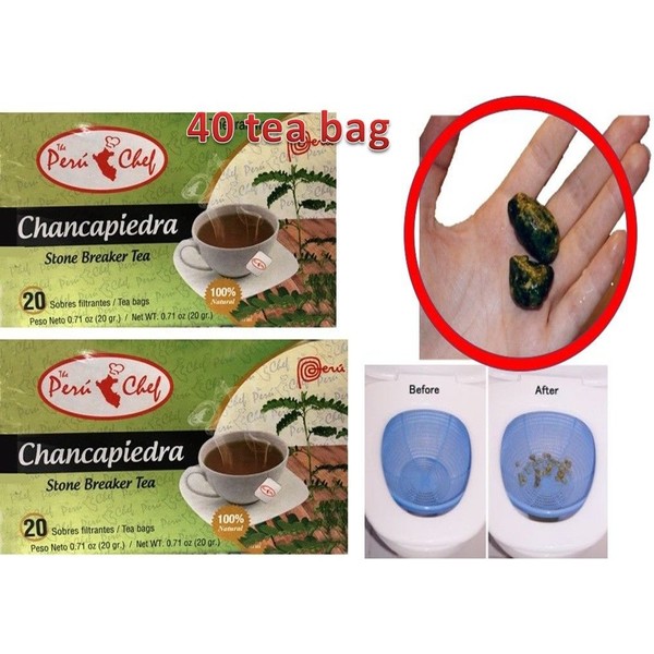 2 CHANCA PIEDRA Tea 40 Bags Chancapiedra Té 40 bolsas Gallbladder Kidney Support Stones Breaker original