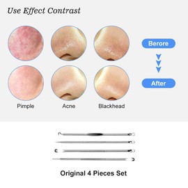 HaimiLiya Pimple Popper Tool Kit-4 Pcs Acne Needle Tools Set- Blackhead Comedone Whitehead Popping Remover Tool for Nose Face Skin Blemish Extractor Tool - Silver