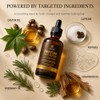 Infina Essentials Peptide Serum Crecimiento Cabello Hombres Mujeres Péptidos Cobre