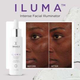 Image Skincare, Iluma - Iluminador Facial Intenso, Suero Ilu                                                                                          