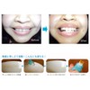 Clear Dent Teeth Peeling Sponges, Pack of 10