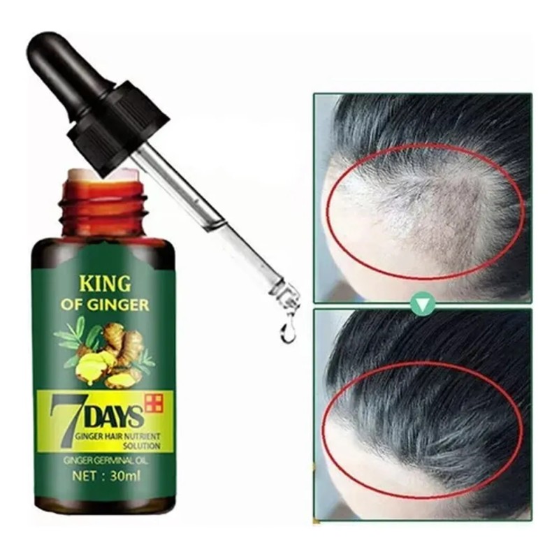 Aceite Germinal De Jengibre For El Crecimiento Del Cabello,