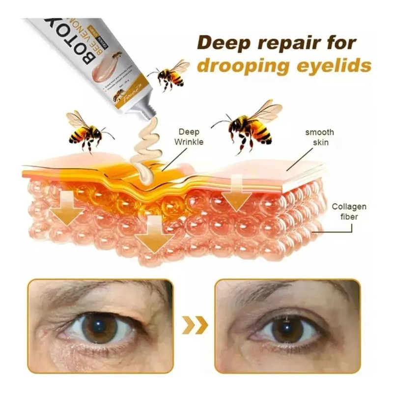 Jlt Crema Removedora De Arrugas Furzero Bot Ff