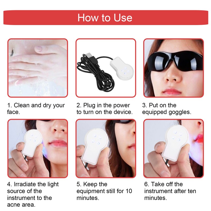 USB Plug In Mini Handheld Acne Removal Machine Blue Light