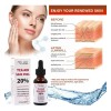 . 30 Ml De Tca Aid Exfoliante Para La Piel,