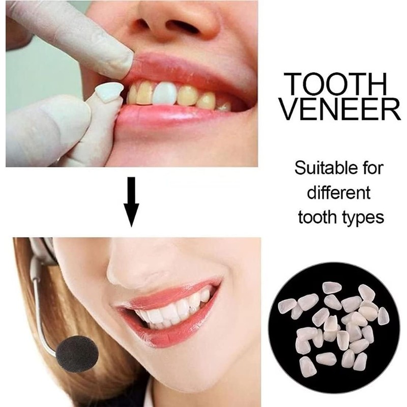 Fake Tooth Repair Kits DIY Dental Care Kit Glue for