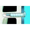 WAKAI 12H-30TS Eccentric Plug Truss, Stainless Steel 6x30, Quantity: 20