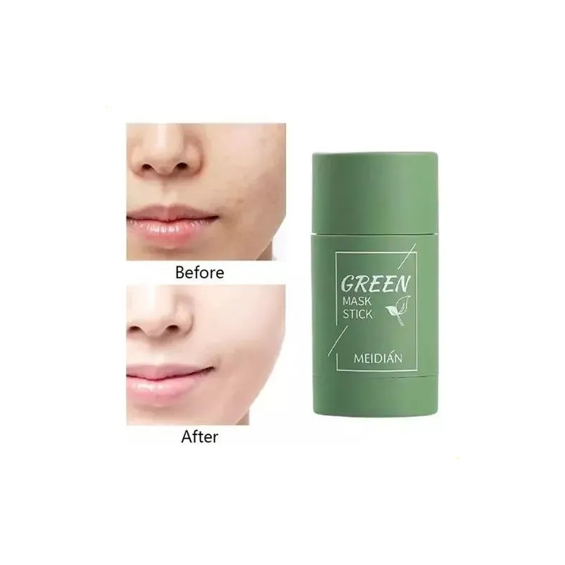 3 Mascarillas Faciales Green Stick Originales Que Eliminan P