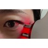 홈케어 ems 피부 미용 관리 얼굴 저주파 고주파 마사지기 뷰티