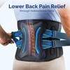 FEATOL Lower Back Brace with 5 Reinforced Stays for Women