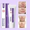 Mopoyat Gel Gel Aplicable A A 10% Elimina Acné Puntos