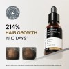Sérum Avanzado Para El Crecimiento Del Cabello Bare Anatomy