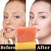 Turmeric Kojic Acid Soap, Kojie Acid Lightening Soaps for Dark