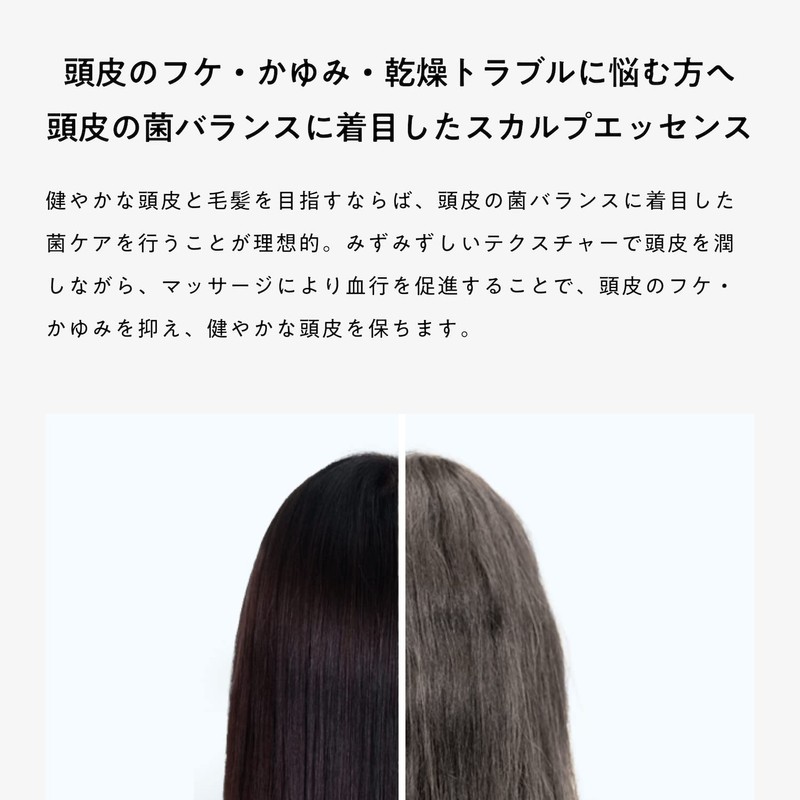 KINS Skype Essence Scalp Care (Weak Acidity, Bacteria Dandruff and