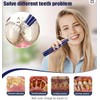 Plaque/Tartar Remover for Teeth, Dental Calculus Remover Teeth Cleaning Kit