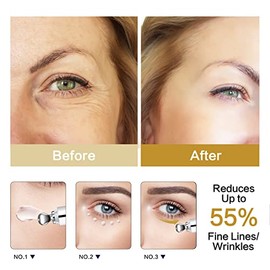 RAZONIX Caffeine Under Eye Cream Anti Aging for Lines and Wrinkles and Dark Circles, Powerful Moisturiser Revitalising Eye Roll On, 20g…
