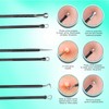 Teenitor Blackhead Remover Tools and Pimple Popper Tool Kit, 9