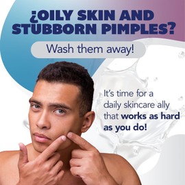 Asepxia Acne Treatment Bar Soap with Baking Soda | Face Wash, Deep Cleansing, Natural Extracts, Gentle Daily Use, 1.8% Salicylic Acid for Pimples & Blackheads, 4 Oz, 1-Pack