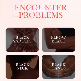 Dark Knuckle Whit-ening Skincare Set - Wh-itening Cream Routine With Niacinamide & Vitamin C -Knee Wh-itening Serum, Joint Whit-ening Essential Oil - Bri-ghtening Cream & Serum for Black Skin 2PCS