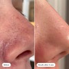 HERO COSMETICS Solución Exfoliante Para Puntos Negros Pore Release, Tónico