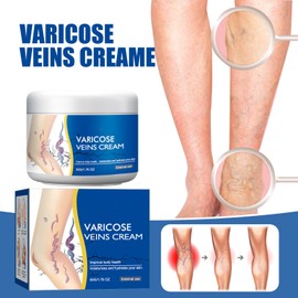Balekotty Varicose Veins Cream for Legs, Skin Cream for Legs, Moisturizing Leg Creams 50g/1.76fl.oz (2PCS)