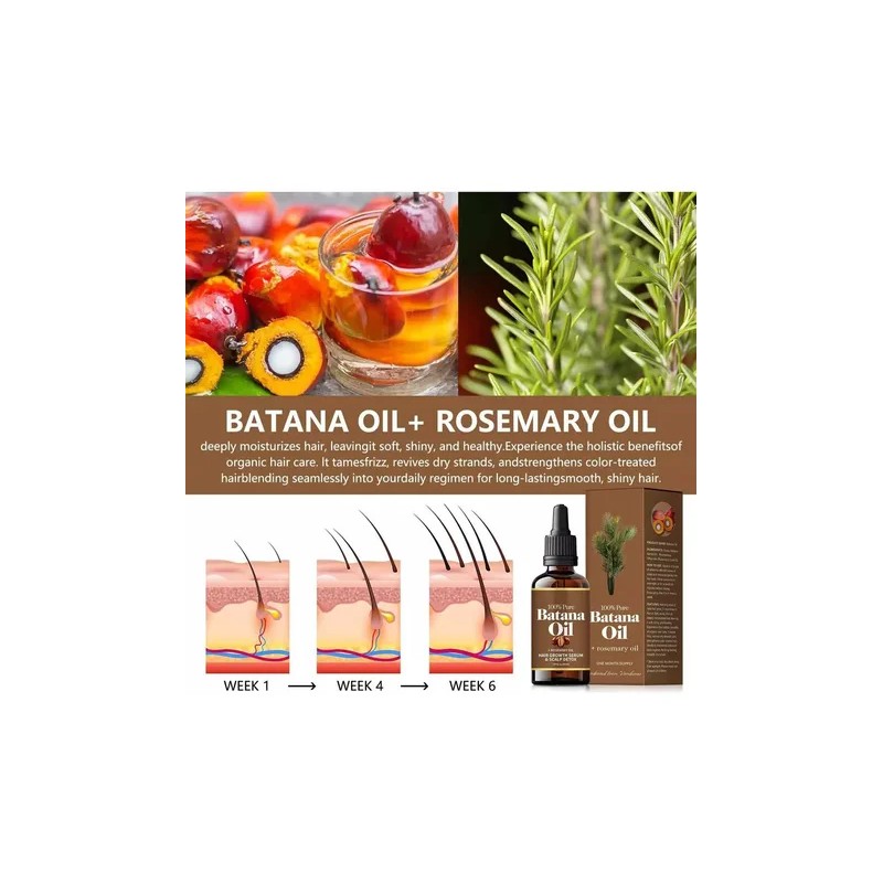 4 Unidades Aceite Batana Orgánico Y Romero