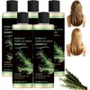 Champú para el crecimiento del cabello de romero,engrosamiento (5pcs)