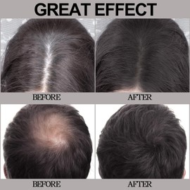 Apooliy Hairline Powder,Hair Shadow for Thinning Hair for Women and Men,Cover Gray Hair Root Touch Up Powder,Hair Shading Filler