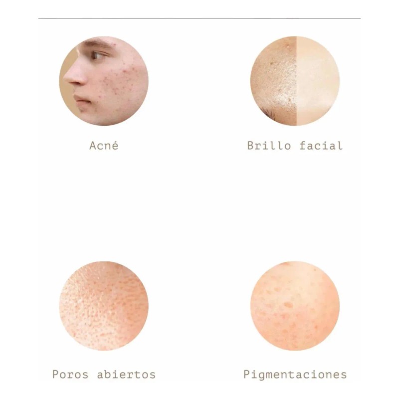 Despigmentante Facial Niacinamida 10% Normal Día/noche