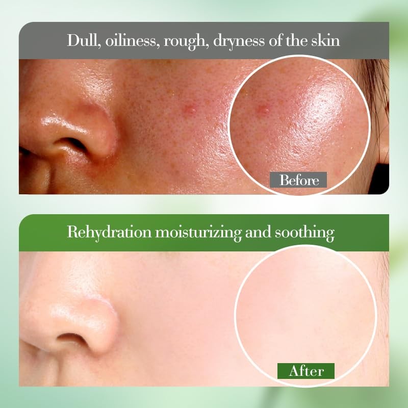 Aloe Vera Moisturizing & Soothing Serum, 40ml, improves the appearance