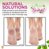 8pk Natural Pumice Stone for Feet | Callus Remover Feet