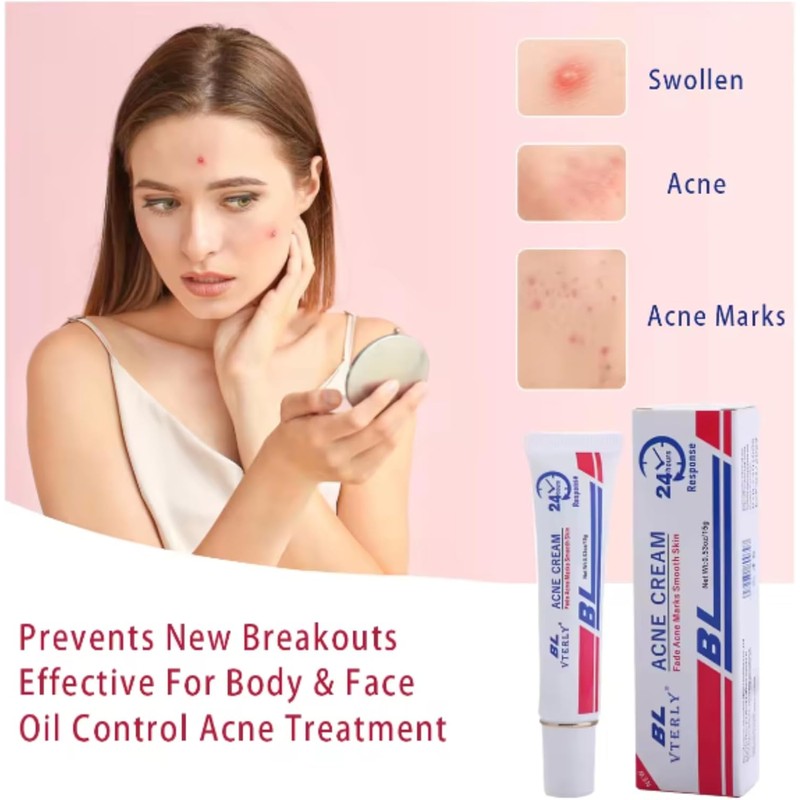 Fast-Acting Acne Scar Treatment Cream - 24-Hour Spot Reduction, Anti-Acne