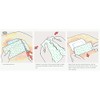 Mefix Self-Adhesive Fabric Tape, Dressing Fixation Fabric Tape, Secures Gauze,